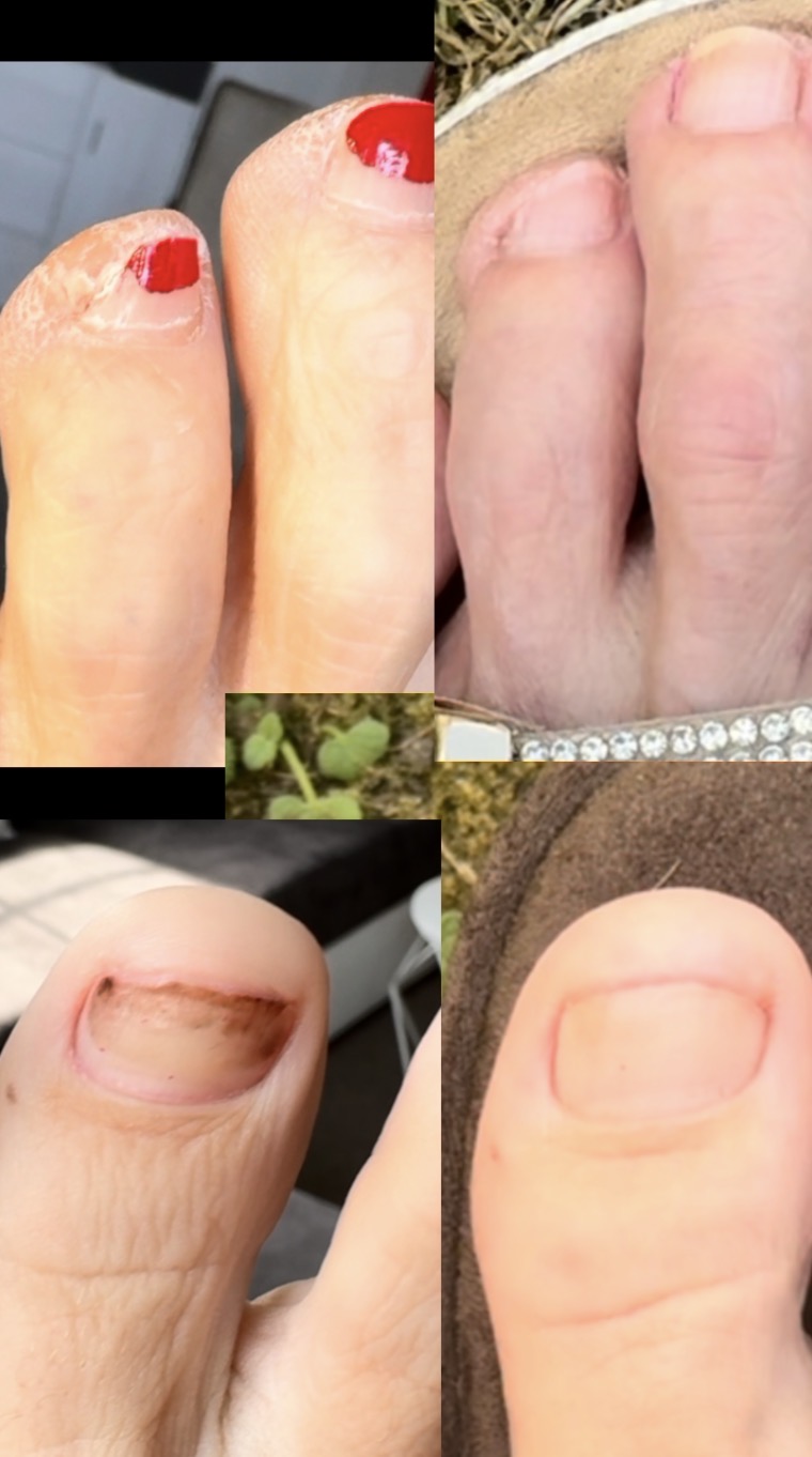 Real 3-month before/after result, no filters — full unedited comparison