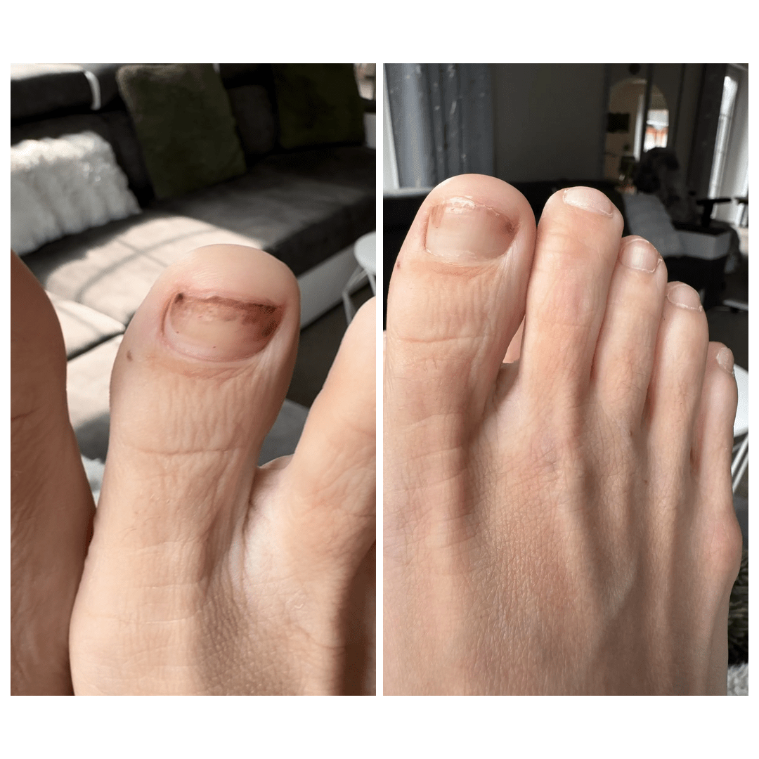 molosoc_how to eliminate dark nails
